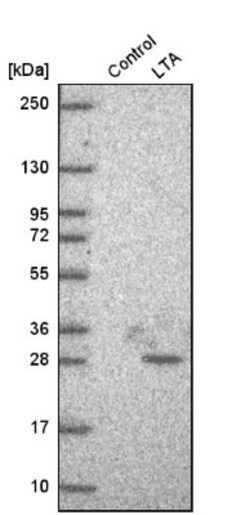 Lymphotoxin-alpha/TNF-beta Antibody, Novus Biologicals 25 &mu;L; Unlabeled:Antibodies,